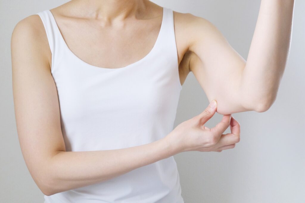 腕の脂肪を触る女性