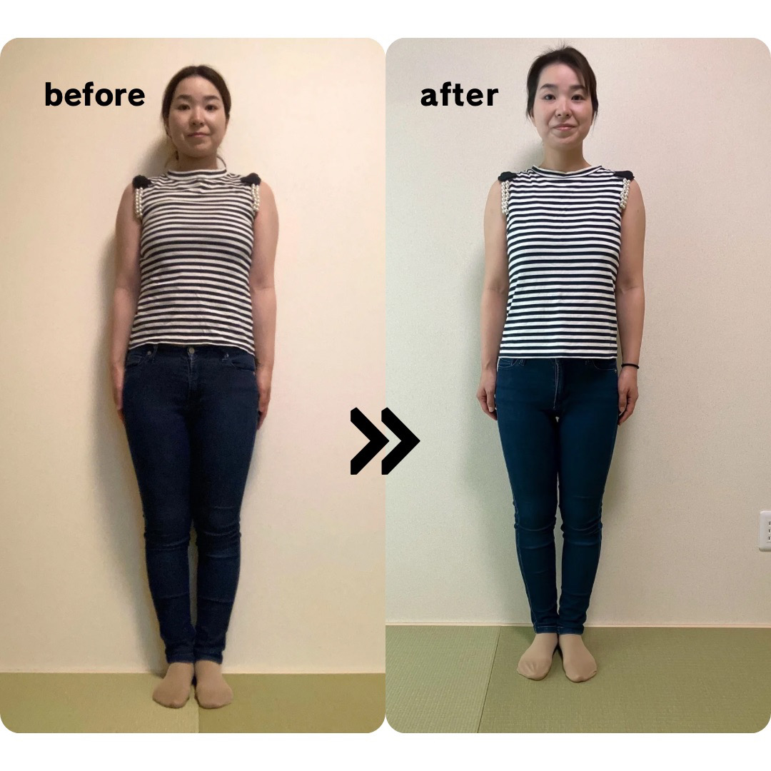 吉池 友紀乃のビフォーアフター写真