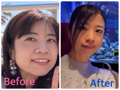 林 朋美のビフォーアフター写真